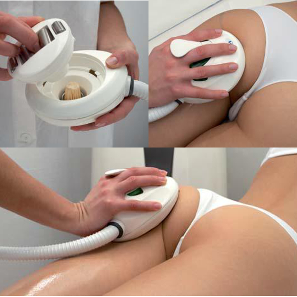 Urządzenie masaż endodermiczny ultradźwiękami RF