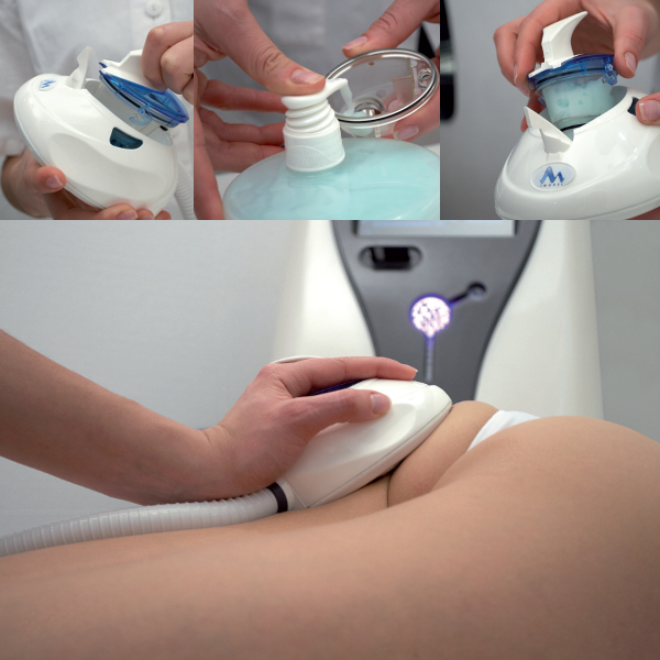 Urządzenie masaż endodermiczny ultradźwiękami